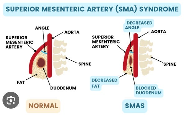 SMAS